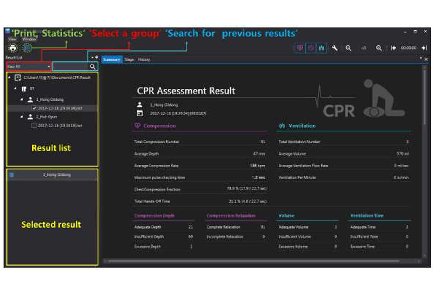 Adult ,Advance CPR simulator